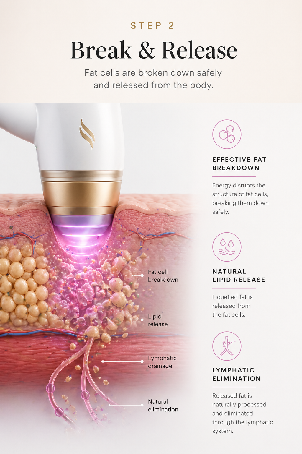 Step 2: Break & Release — Fat cells are broken down safely and released from the body.
